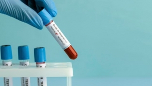 Omicron Varyantı Hızla Yayılıyor!