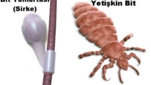 Okullar açıldı çocuklarda bit oranı arttı