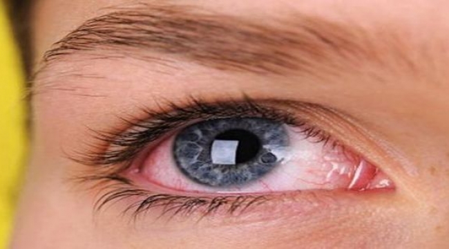 Ekran kullanımı göz hastalıklarını artırıyor