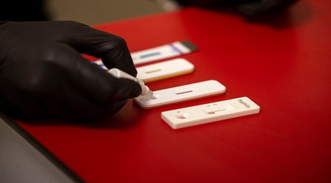 Büyükşehir'den kimliksiz ve ücretsiz test hizmeti